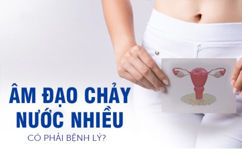 Âm đạo chảy nước nhiều có phải là bị bệnh lý