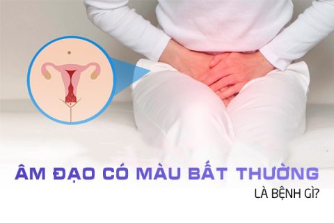 Âm đạo có màu bất thường là bệnh gì