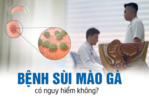 Bệnh sùi mào gà có nguy hiểm không