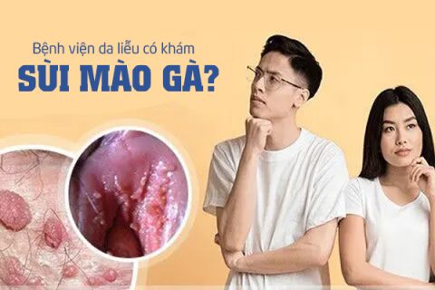 Bệnh viện da liễu có khám sùi mào gà không