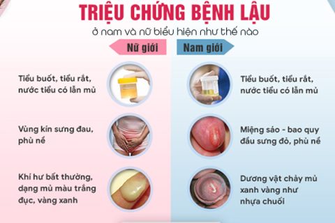 Các triệu chứng của bệnh lậu ở nam và nữ biểu hiện như thế nào