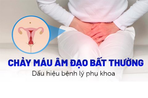 Chảy máu âm đạo Dấu hiệu bệnh lý phụ khoa
