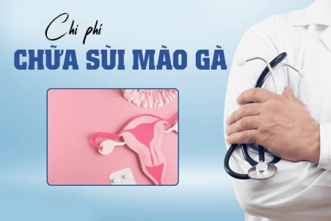 Chi phí chữa sùi mào gà tiết kiệm