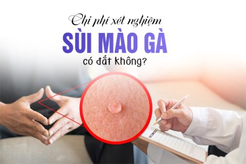 Chi phí xét nghiệm sùi mào gà có đắt không