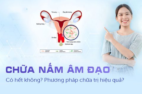 Chữa nấm âm đạo có hết không Phương pháp chữa trị hiệu quả