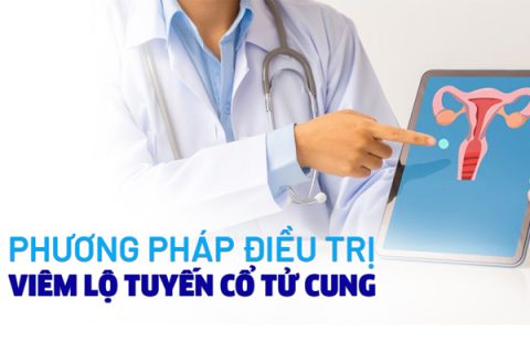 Chữa trị viêm lộ tuyến bằng cách nào hiệu quả