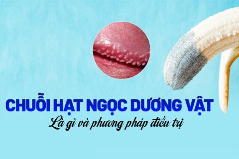 Chuỗi hạt ngọc dương vật là gì Phương pháp điều trị hiệu quả