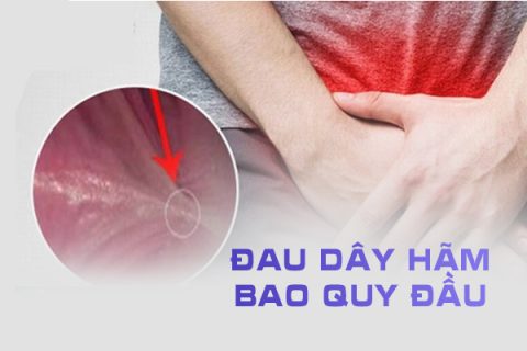 Đau dây hãm bao quy đầu