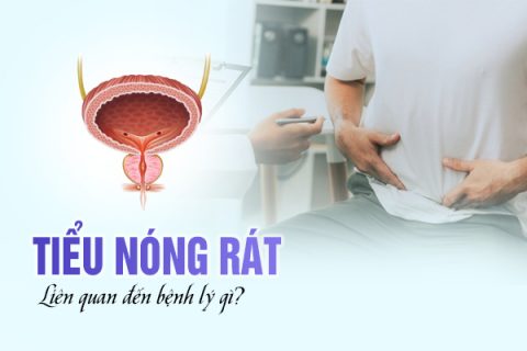 Đi tiểu nóng rát liên quan đến bệnh lý gì