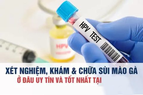 Địa chỉ xét nghiệm sùi mào gà ở đâu uy tín