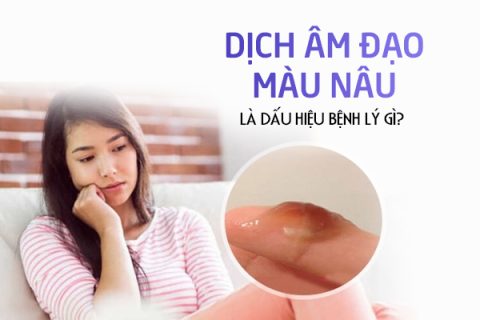 Dịch âm đạo màu nâu là dấu hiệu bệnh lý gì
