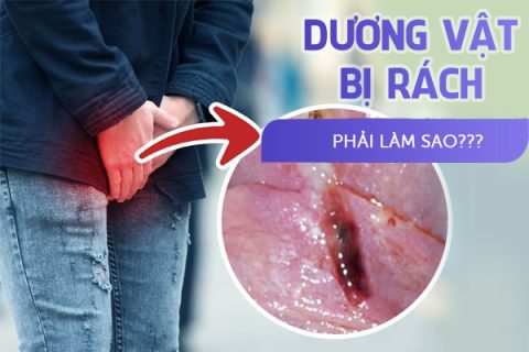 Dương vật bị rách phải làm sao