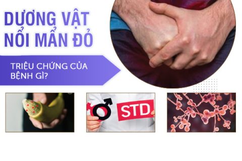 Dương vật nổi mẩn đỏ là triệu chứng của bệnh gì