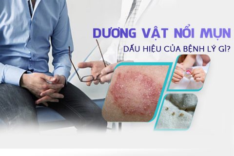 Dương vật nổi mụn là dấu hiệu của bệnh lý gì