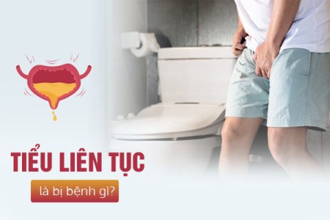 Giải đáp đi tiểu liên tục là bị bệnh gì