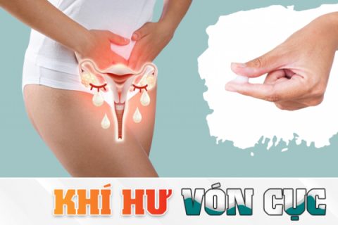 Khí hư là gì Thế nào là khí hư vón cục
