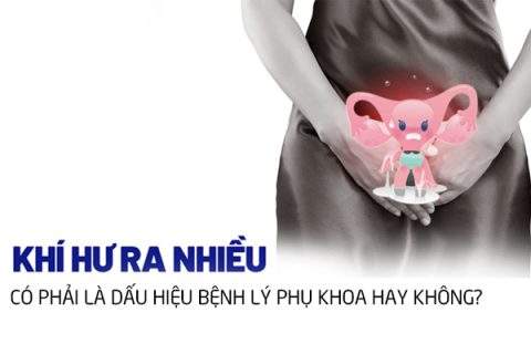Khí hư ra nhiều có phải là bị bệnh lý phụ khoa không