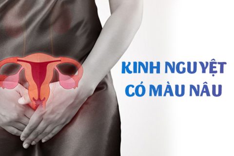 Kinh nguyệt có màu nâu là dấu hiệu của bệnh gì