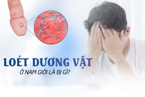 Loét dương vật nam giới bị bệnh gì