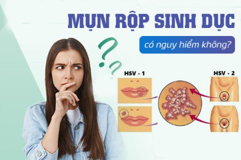 Mụn rộp sinh dục có nguy hiểm không