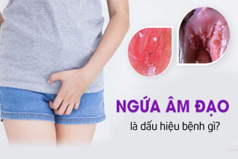 Ngứa âm đạo là dấu hiệu bệnh gì