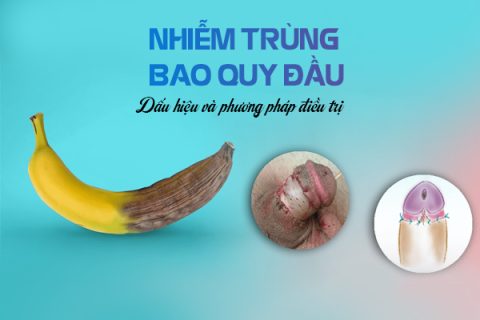 Nhiễm trùng bao quy đầu Dấu hiệu và phương pháp điều trị