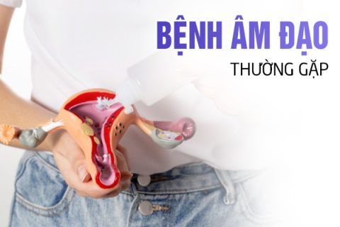 Những bệnh âm đạo thường gặp là gì