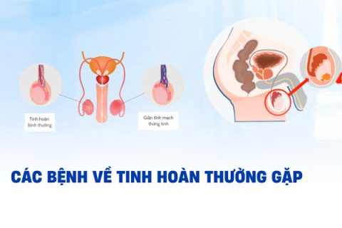 Những bệnh tinh hoàn thường gặp ở nam giới