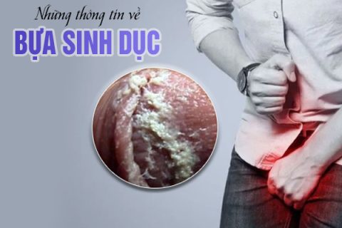 Những thông tin về bựa sinh dục