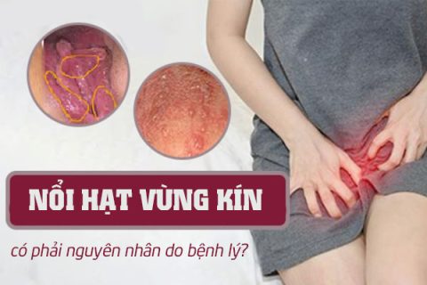Nổi hạt vùng kín có phải nguyên nhân do bệnh lý