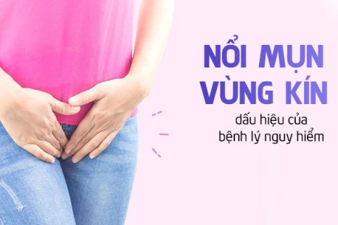 Nổi mụn vùng kín là dấu hiệu của bệnh lý nguy hiểm