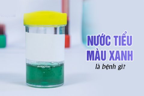 Nước tiểu có màu xanh là bệnh gì