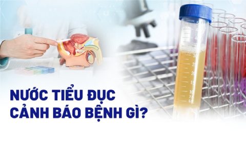 Nước tiểu đục là dấu hiệu của bệnh lý gì