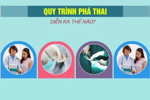 Quy trình phá thai diễn ra như thế nào