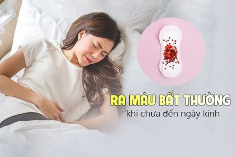 Ra máu bất thường khi chưa đến ngày kinh