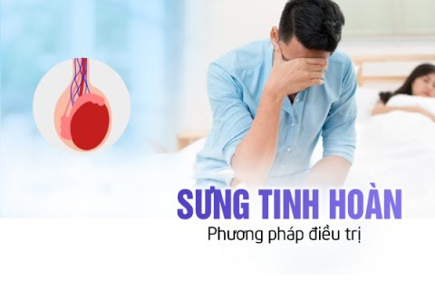 Sưng tinh hoàn và phương pháp điều trị