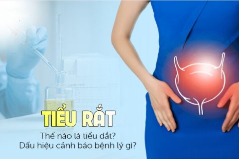 Thế nào là tiểu dắt Dấu hiệu cảnh báo bệnh lý gì