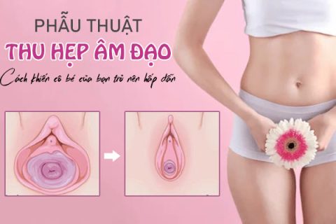 Thu hẹp âm đạo Cách khiến cô bé của bạn trở nên hấp dẫn