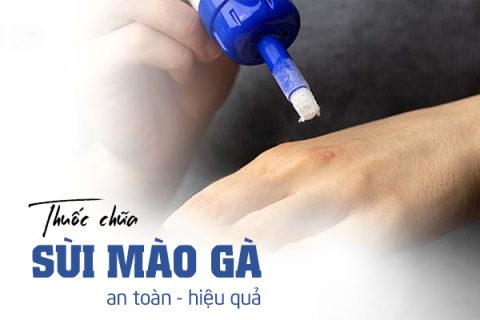 Thuốc chữa sùi mào gà hiệu quả