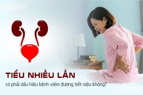 Tiểu nhiều lần có phải dấu hiệu bệnh viêm đường tiết niệu không