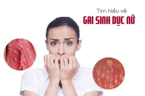 Tìm hiểu về gai sinh dục ở nữ