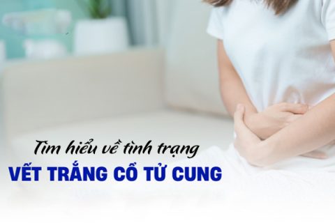 Tìm hiểu về tình trạng vệt trắng ở tử cung