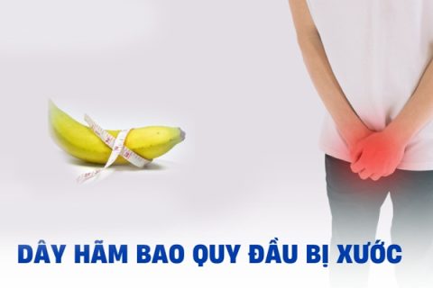 Tình trạng xước dây hãm bao quy đầu