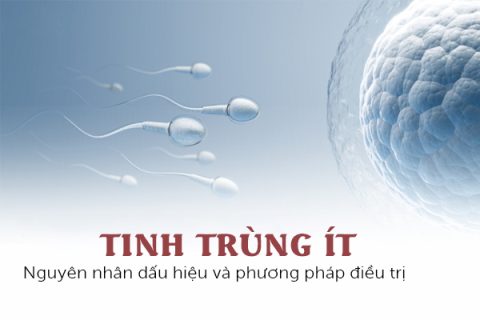 Tinh trùng ít Nguyên nhân dấu hiệu và phương pháp điều trị