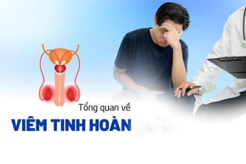 Tổng quan về bệnh viêm tinh hoàn ở nam giới