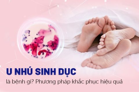 U nhú sinh dục là bệnh gì Phương pháp khắc phục hiệu quả