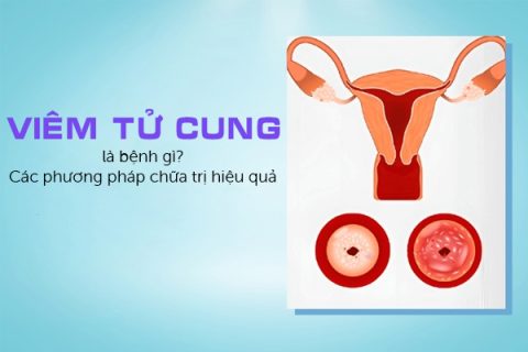 Viêm tử cung là bệnh gì Các phương pháp chữa trị hiệu quả