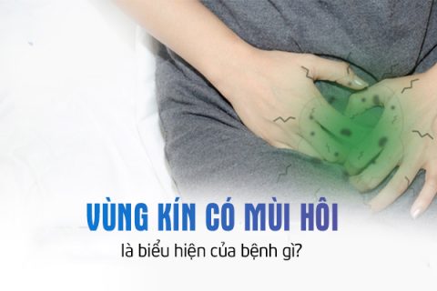 Vùng kín có mùi hôi là biểu hiện của bệnh gì