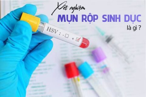 Xét nghiệm mụn rộp sinh dục là gì