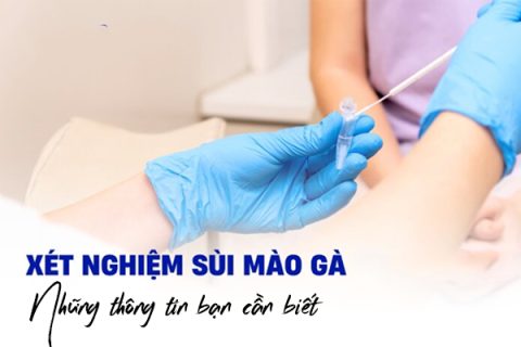 Xét nghiệm sùi mào gà Những thông tin bạn cần biết